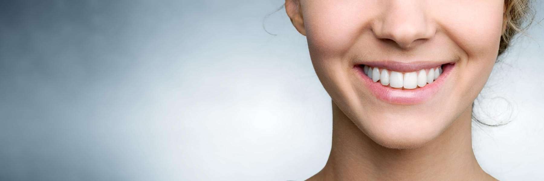 Porcelain Veneers | Dentist